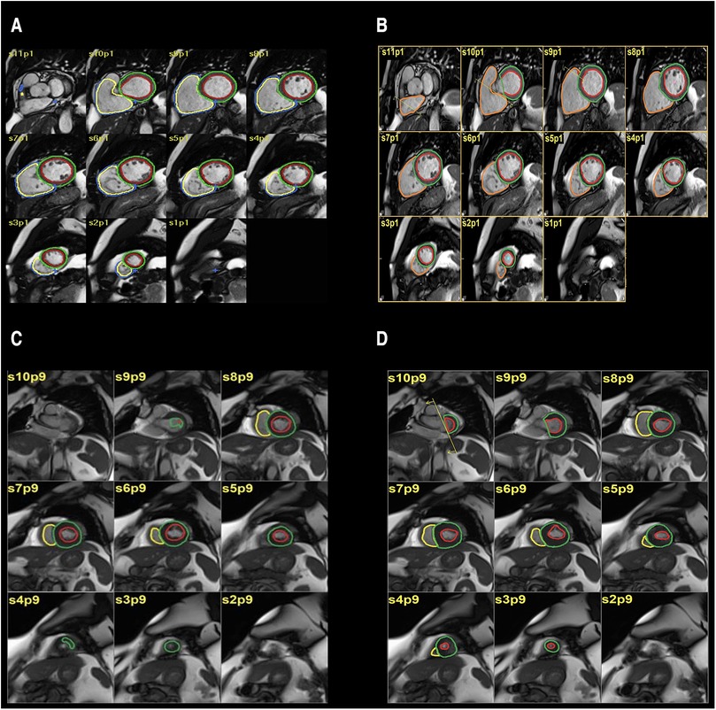 Frontiers in Cardiovascular Medicine